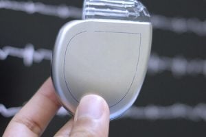 big-Dispositivo Cardíaco Eletrônico Implantável