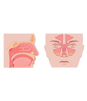 big-Módulo-RINOLOGIA