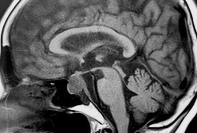 big-Neuroendocrino