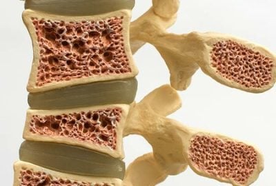 big-Osteometabolismo