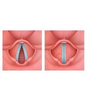 big-módulo-LARINGOLOGIA