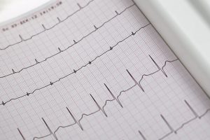 large-Fibrilação Atrial